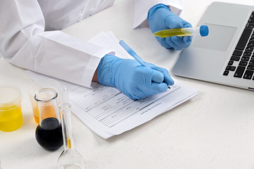 흰색 가운과 파란색 장갑을 착용한 검사자가 유기산 검사(Organic Acids Test)를 위해 노란색 소변 샘플이 담긴 튜브를 들고 분석 기록지에 데이터를 작성하는 모습