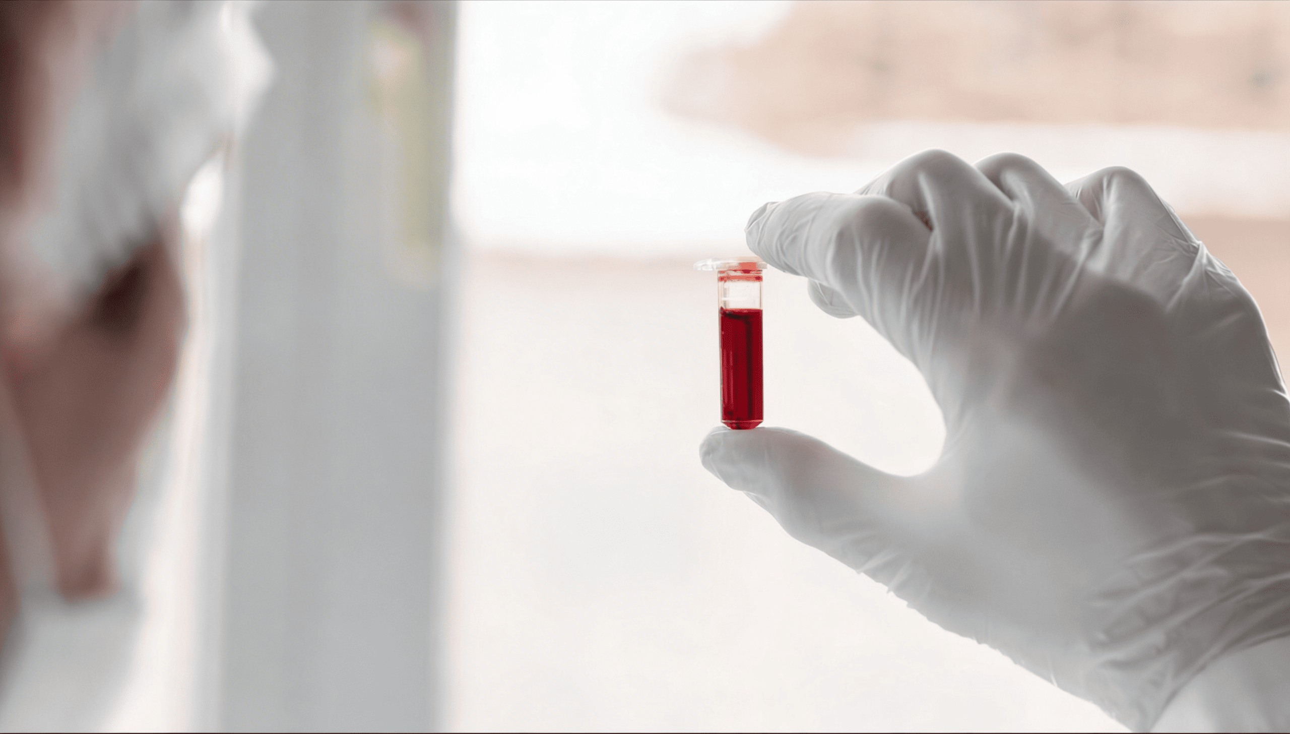 흰색 가운과 보호 장갑을 착용한 의료진이 혈액 샘플이 담긴 작은 투명 채혈관을 손가락으로 들어 밝은 빛 아래에서 세밀하게 검사하고 있는 모습