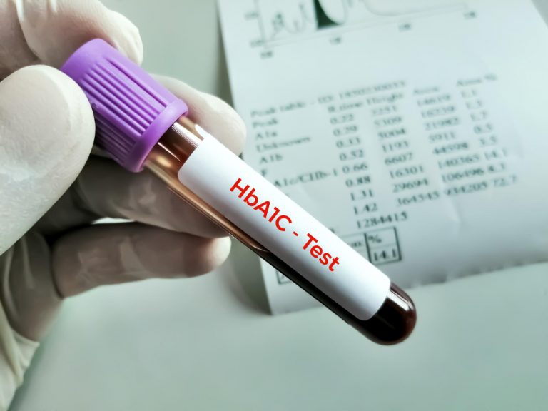 당화혈색소(HbA1c) 검사 혈액 채취관과 검사 결과지 — 당뇨 전단계 진단 및 정체기 점검