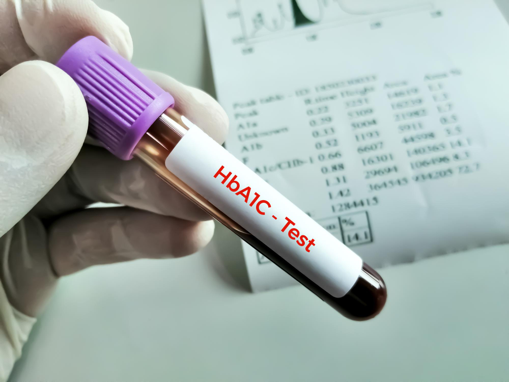 당화혈색소(HbA1c) 검사 혈액 채취관과 검사 결과지 — 당뇨 전단계 진단 및 정체기 점검