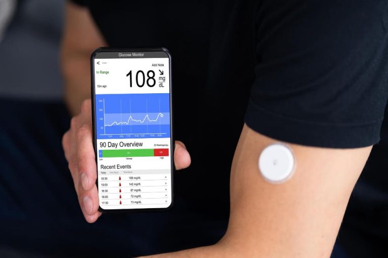 팔에 연속혈당측정기(CGM) 센서를 부착하고 스마트폰 혈당 모니터링 앱으로 실시간 혈당 변동성을 확인하는 당뇨 환자 — Time in Range 관리