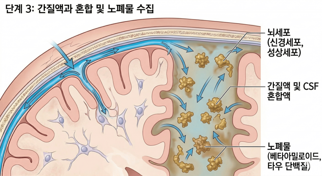 단계 3: 간질액과 혼합 및 노폐물 수집 alt text: 글림패틱 시스템 3단계 — 뇌척수액과 간질액이 혼합되면서 베타아밀로이드·타우 단백질 등 노폐물을 수집하는 과정을 나타낸 의학 일러스트. 뇌세포(신경세포·성상세포) 사이에서 노폐물이 혼합액에 포집되는 흐름을 보여준다.