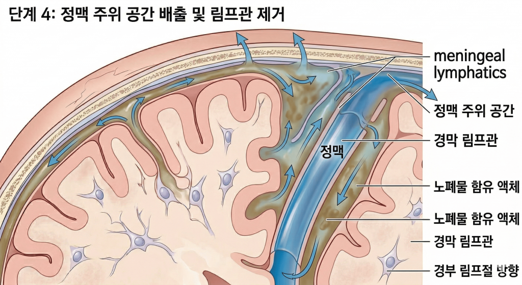 단계 4: 정맥 주위 공간 배출 및 림프관 제거 alt text: 글림패틱 시스템 4단계 — 노폐물을 함유한 간질액이 정맥 주위 공간을 통해 배출되고 경막 림프관(meningeal lymphatics)을 거쳐 경부 림프절 방향으로 최종 제거되는 과정을 나타낸 의학 일러스트.