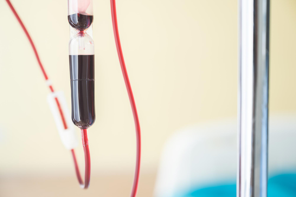 자외선 혈액치료에 사용되는 혈액 채취 튜브와 수혈 라인 클로즈업
English alt: Close-up of blood collection tube and transfusion line used in ultraviolet blood irradiation therapy
