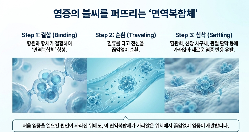 면역복합체가형성된후 인체내 다양한곳에서 새로운 염증반응을 유발한다는 이미지 